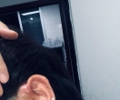 宁德哪里可以治疗耳前瘘管发炎的地方啊，不想引流手术，太遭罪了